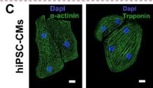 Fig.1.C showing Immunocytochemistry-immunofluorescence in a Homo sapiens (Human) sample from the publication: Metabolic fatty acid substrates enhance the structural and mechanical performance of human-induced pluripotent stem cell-derived cardiomyocytes.