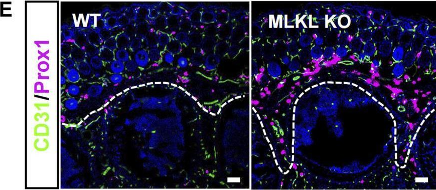 Fig.4.M showing Immunohistochemistry-immunofluorescence in a Mus musculus (House mouse) sample from the publication: Evidence for developmental vascular-associated necroptosis and its contribution to venous-lymphatic endothelial differentiation.