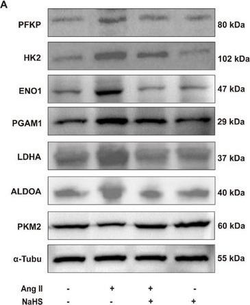 Fig.5.A showing Western Blotting from the publication: NFS1 Regulates IDH2 to Attenuate Abdominal Aortic Aneurysms via Interacting With SP2.
