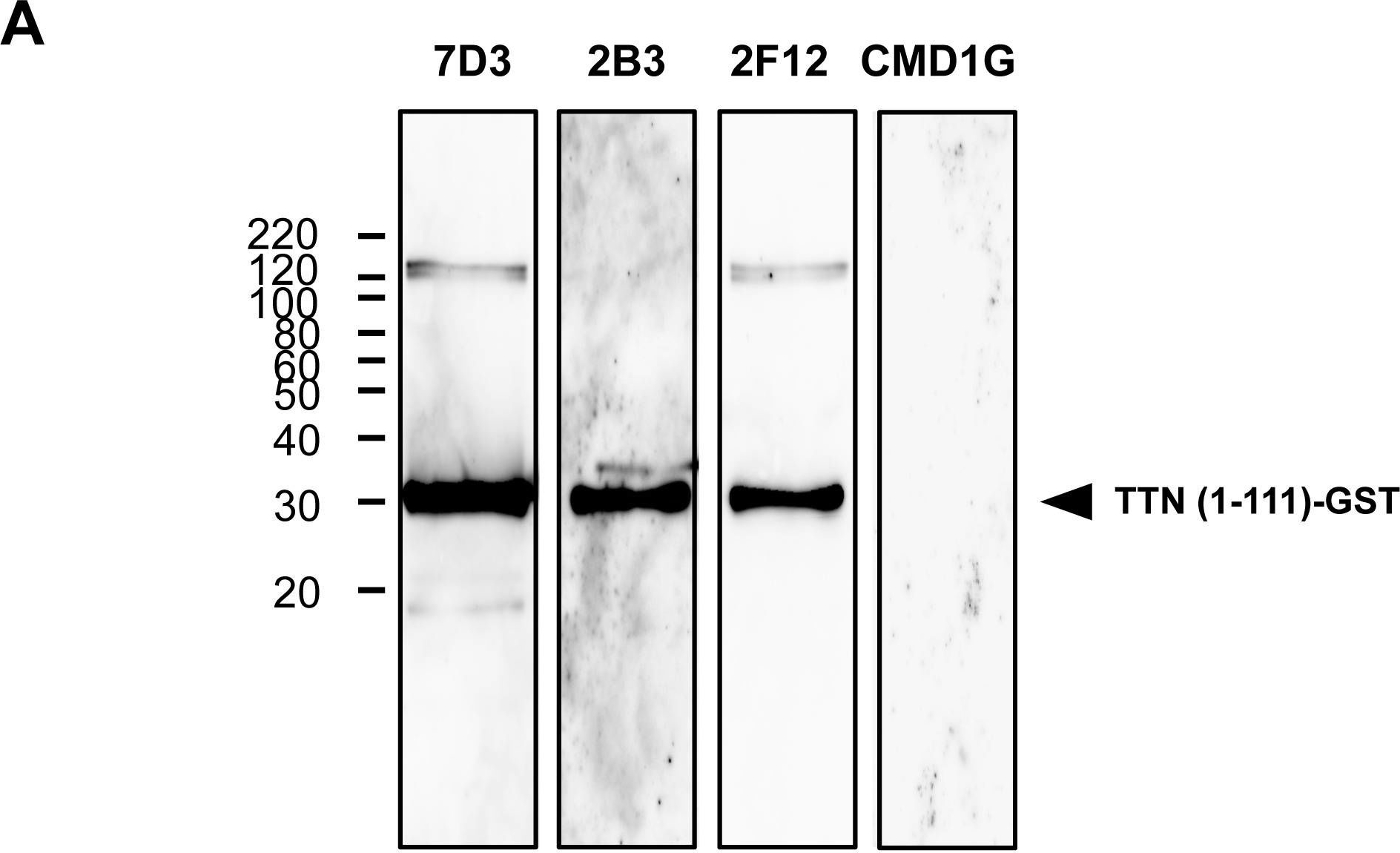 Fig.3.A showing Western Blotting in a Homo sapiens (Human) sample from the publication: Detection of titin fragments in urine in response to exercise-induced muscle damage.