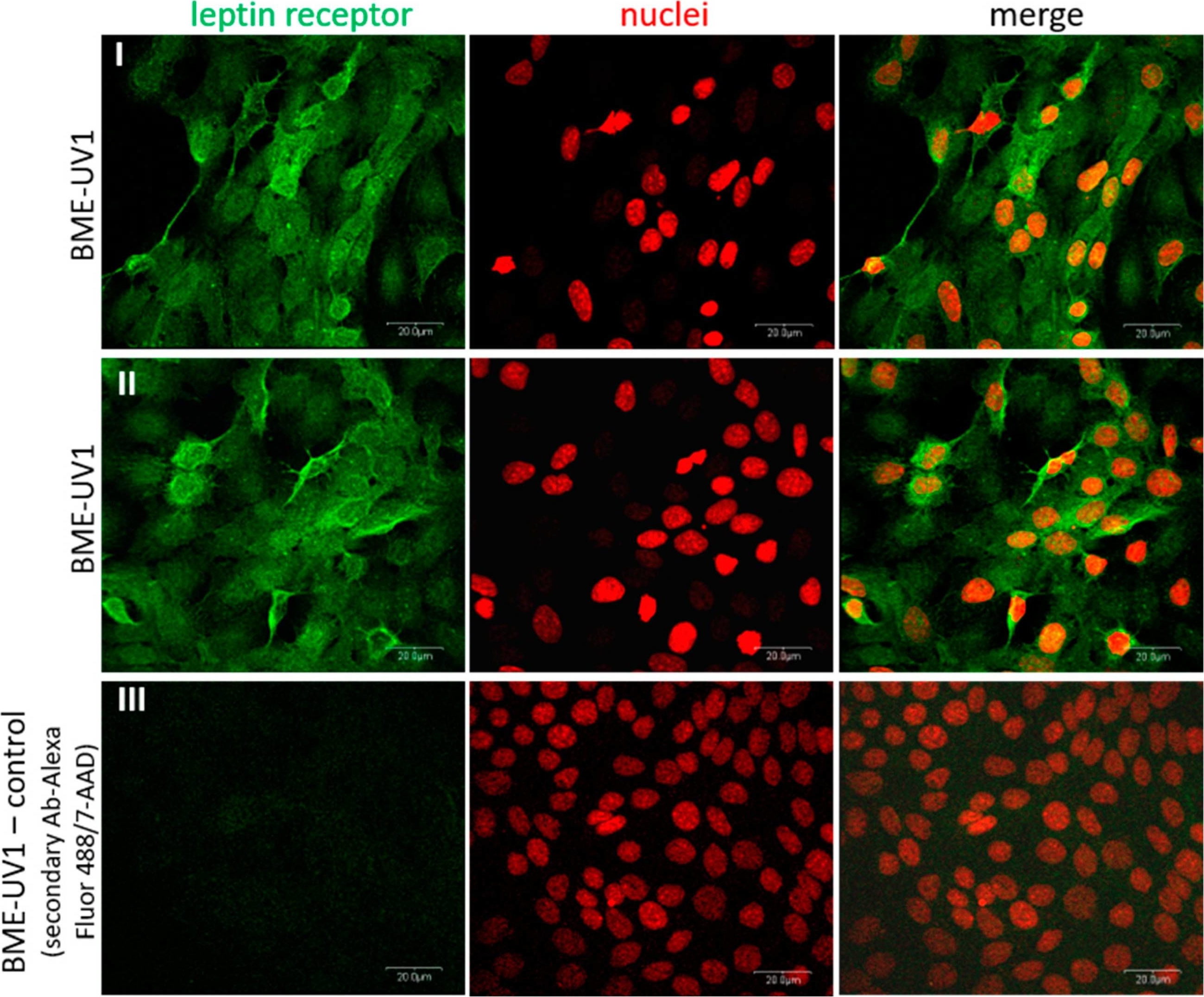 Fig.3.A showing Immunocytochemistry-immunofluorescence in a Bos taurus (Bovine) sample from the publication: Chemerin Stimulates the Secretory Activity of BME-UV1 Bovine Mammary Epithelial Cells.