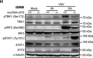 Fig.5.H showing Western Blotting in a Mus musculus (House mouse) sample from the publication: LincRNA-EPS impairs host antiviral immunity by antagonizing viral RNA-PKR interaction.