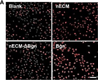 Fig.6.A showing Immunocytochemistry-immunofluorescence from the publication: Biglycan Reconstitutes a Neonatal ECM Signaling Microenvironment to Drive Stem Cell-Mediated Tendon Regeneration via a Scaffold-Free Cell Sheet Platform.