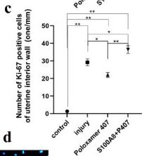 Fig.3.C from the publication: S100A8 regulated by estrogen improves injured endometrial epithelium reconstruction by promoting tight junction formation and stromal cell transformation.