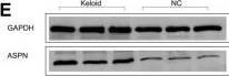 Fig.4.E showing Western Blotting from the publication: Identification of nanoparticle-mediated siRNA-ASPN as a key gene target in the treatment of keloids.