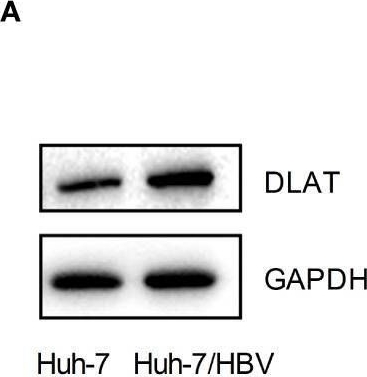 Fig.9.A showing Western Blotting in a Homo sapiens (Human) sample from the publication: Hepatitis B-related hepatocellular carcinoma: classification and prognostic model based on programmed cell death genes.