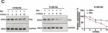 Fig.2.C showing Western Blotting from the publication: Glutamine transporter SLC1A5 inhibits autophagy-mediated CD276 degradation to promote esophageal cancer progression.