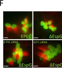 Fig.6.F showing Immunocytochemistry-immunofluorescence from the publication: A kinase-independent function of PAK is crucial for pathogen-mediated actin remodelling.