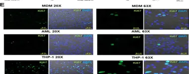 Fig.3.E showing Immunocytochemistry-immunofluorescence from the publication: A new tractable method for generating human alveolar macrophage-like cells in vitro to study lung inflammatory processes and diseases.