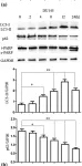 Fig.1.A showing Western Blotting in a Homo sapiens (Human) sample from the publication: Inhibiting autophagy overcomes docetaxel resistance in castration-resistant prostate cancer cells.