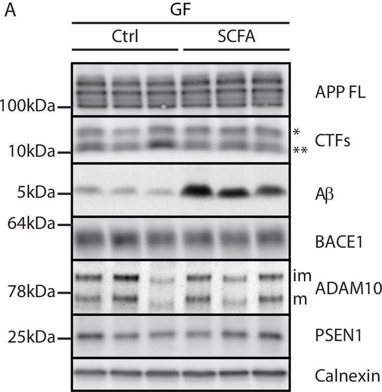 Fig.3.A showing Western Blotting from the publication: Microbiota-derived short chain fatty acids modulate microglia and promote Aβ plaque deposition.