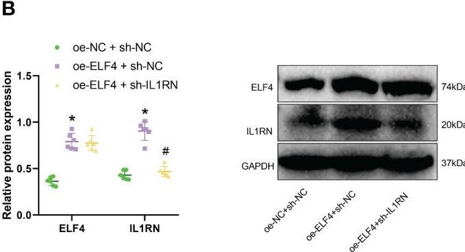 Fig.5.B showing Western Blotting in a Mus musculus (House mouse) sample from the publication: The transcription factor ELF4 alleviates inflammatory bowel disease by activating IL1RN transcription, suppressing inflammatory TH17 cell activity, and inducing macrophage M2 polarization.