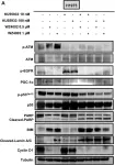 Fig.4.A showing Western Blotting from the publication: ATM inhibition blocks glucose metabolism and amplifies the sensitivity of resistant lung cancer cell lines to oncogene driver inhibitors.