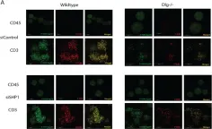 Fig.4.A showing Immunocytochemistry-immunofluorescence in a Homo sapiens (Human) sample from the publication: Disc Large Homolog 1 Is Critical for Early T Cell Receptor Micro Cluster Formation and Activation in Human T Cells.