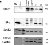 Fig.4.C showing Western Blotting from the publication: Quantitative Proteomics and Differential Protein Abundance Analysis after Depletion of Putative mRNA Receptors in the ER Membrane of Human Cells Identifies Novel Aspects of mRNA Targeting to the ER.