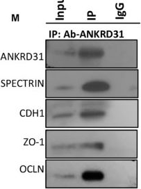 Fig.6.M showing Western Blotting from the publication: Ankrd31 in Sperm and Epididymal Integrity.