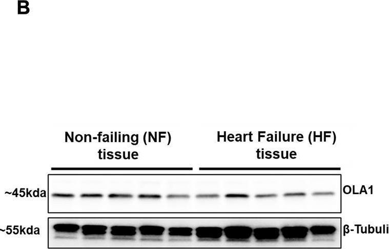 Fig.1.B showing Western Blotting in a Homo sapiens (Human) sample from the publication: Identification and development of Tetra-ARMS PCR-based screening test for a genetic variant of OLA1 (Tyr254Cys) in the human failing heart.