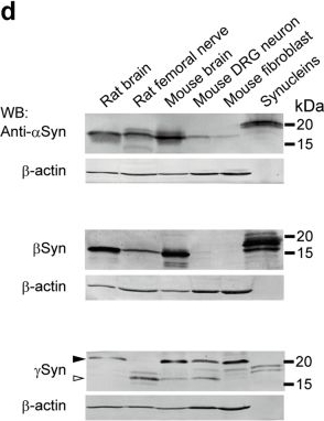 Fig.1.D showing Western Blotting in a Rattus norvegicus (Rat) sample from the publication: Alpha-synuclein facilitates to form short unconventional microtubules that have a unique function in the axonal transport.