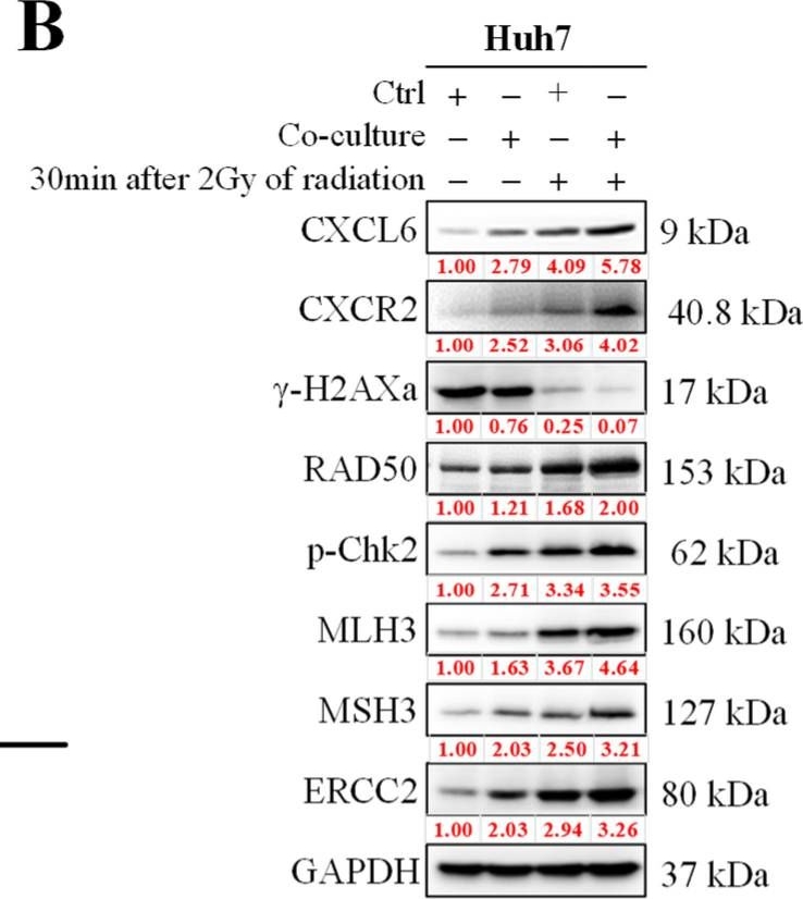 Fig.4.B showing Western Blotting in a Homo sapiens (Human) sample from the publication: Tumor-Associated Macrophages Affect the Tumor Microenvironment and Radioresistance via the Upregulation of CXCL6/CXCR2 in Hepatocellular Carcinoma.
