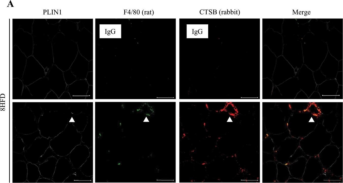 Cathepsin B overexpression induces degradation of perilipin 1 to cause lipid metabolism dysfunction in adipocytes.