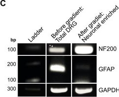 Fig.12.C showing Western Blotting from the publication: CITED2 is a druggable epigenetic switch coupling&nbsp;neuronal maturation to regenerative decline.