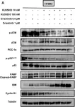 Fig.5.A showing Western Blotting from the publication: ATM inhibition blocks glucose metabolism and amplifies the sensitivity of resistant lung cancer cell lines to oncogene driver inhibitors.