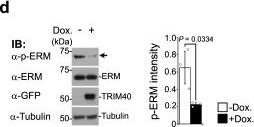 Ezrin/Radixin/Moesin Antibody | Cell Signaling Technology