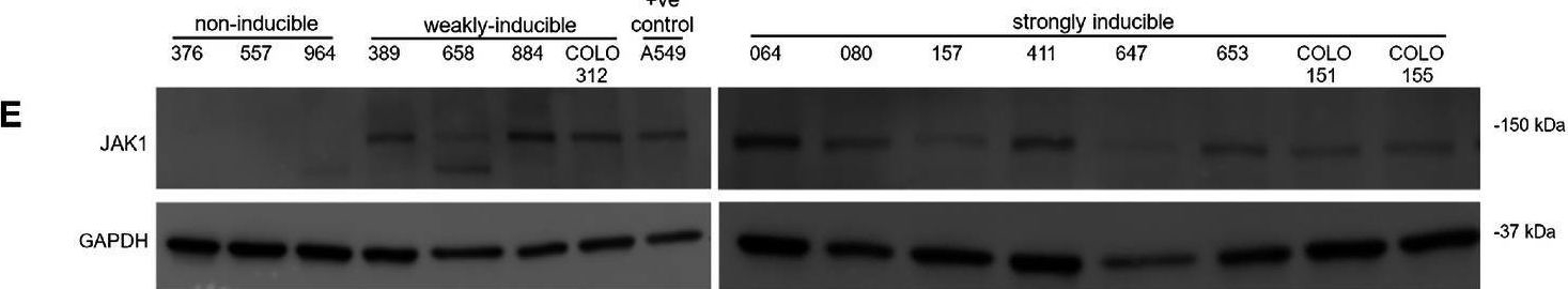 Fig.2.E showing Western Blotting in a Homo sapiens (Human) sample from the publication: MHC Class II is Induced by IFNγ and Follows Three Distinct Patterns of Expression in Colorectal Cancer Organoids.