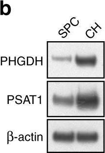 Fig.1.B showing Western Blotting from the publication: De novo serine synthesis regulates chondrocyte proliferation during bone development and repair.