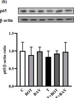 Fig.9.B showing Western Blotting from the publication: Boiogito Ameliorates Inflammation-Associated Adipocyte Dysfunction and Restores Adipogenesis in Association with Suppression of NF-κB Signaling.