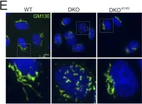 Fig.6.E showing Immunocytochemistry-immunofluorescence in a Homo sapiens (Human) sample from the publication: ERLIN1/2 scaffolds bridge TMUB1 and RNF170 and restrict cholesterol esterification to regulate the secretory pathway.