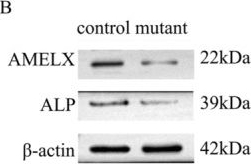 Fig.6.B showing Western Blotting in a Homo sapiens (Human) sample from the publication: A Novel FAM83H Truncation Mutation Disrupts Enamel Mineralization in Autosomal Dominant Hypocalcified Amelogenesis Imperfecta.