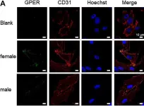 Fig.2.A showing Immunocytochemistry-immunofluorescence in a Homo sapiens (Human) sample from the publication: Sex Differences in the Pro-Angiogenic Response of Human Endothelial Cells: Focus on PFKFB3 and FAK Activation.