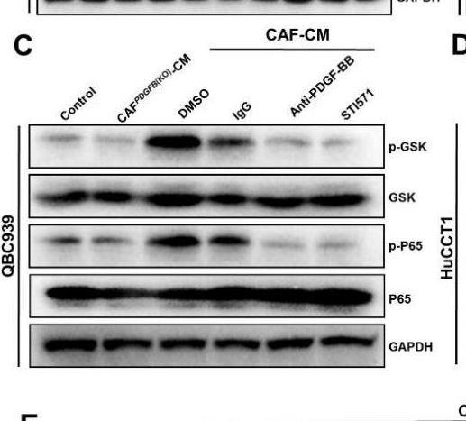Fig.8.C showing Western Blotting in a Homo sapiens (Human) sample from the publication: Cancer-Associated Fibroblasts Promote Lymphatic Metastasis in Cholangiocarcinoma via the PDGF-BB/PDGFR-β Mediated Paracrine Signaling Network.