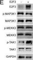 Fig.5.E showing Western Blotting from the publication: E2F3 activates NF-κB signaling through TRIM26 mediated TAB1 ubiquitination in pancreatic cancer.