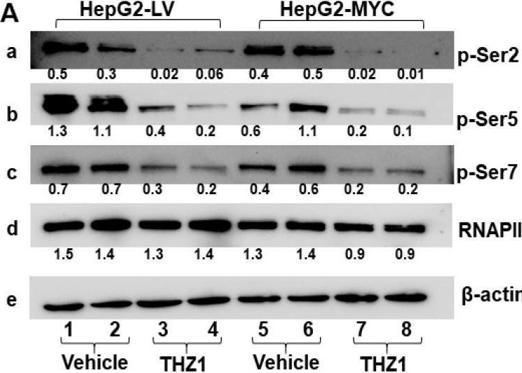 Fig.7.A showing Western Blotting in a Homo sapiens (Human) sample from the publication: Converged DNA Damage Response Renders Human Hepatocellular Carcinoma Sensitive to CDK7 Inhibition.