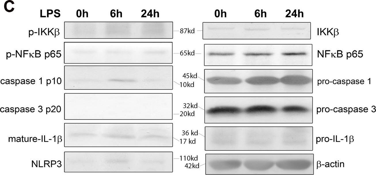 Fig.2.C showing Western Blotting in a Mus musculus (House mouse) sample from the publication: Periodontal inflammation recruits distant metastatic breast cancer cells by increasing myeloid-derived suppressor cells.