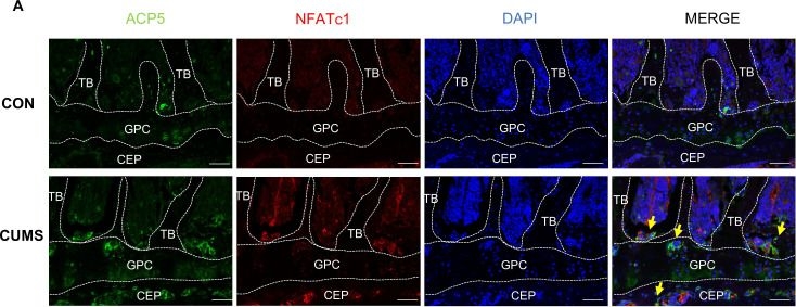 Fig.5.A showing Immunohistochemistry-immunofluorescence from the publication: MiR-1a-3p/Fcgr4-dependent osteoclast activation regulates pathological bone loss.