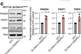 Fig.4.C showing Western Blotting in a Homo sapiens (Human) sample from the publication: Phenotypic profiling of solute carriers characterizes serine transport in cancer.