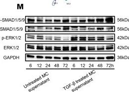 Fig.4.M showing Western Blotting from the publication: Distinct mural cells and fibroblasts drive fibrochondrogenesis in retrodiscal tissue following temporomandibular joint disc displacement.
