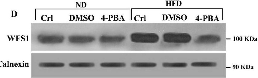 Fig.4.D showing Western Blotting from the publication: Endoplasmic reticulum stress inhibition ameliorated WFS1 expression alterations and reduced pancreatic islets' insulin secretion induced by high-fat diet in rats.