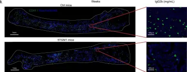 Fig.1.K showing Immunohistochemistry-immunofluorescence from the publication: Excessive serine from the bone marrow microenvironment impairs megakaryopoiesis and thrombopoiesis in Multiple Myeloma.