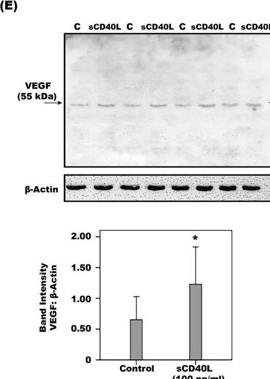 Fig.13.E showing Western Blotting in a Homo sapiens (Human) sample from the publication: CD40 Ligand-CD40 Interaction Is an Intermediary between Inflammation and Angiogenesis in Proliferative Diabetic Retinopathy.