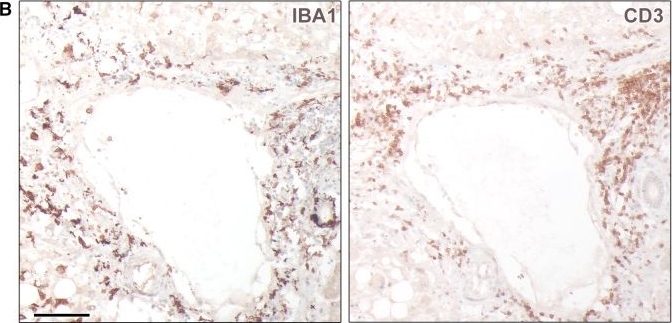 Fig.1.B showing Immunohistochemistry from the publication: Fatal Dengue Fever in a Traveler Returning from Togo to Germany.