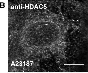 Fig.4.B showing Immunocytochemistry-immunofluorescence from the publication: Sarcoplasmic reticulum Ca2+ -induced Ca2+ release regulates class IIa HDAC localization in mouse embryonic cardiomyocytes.