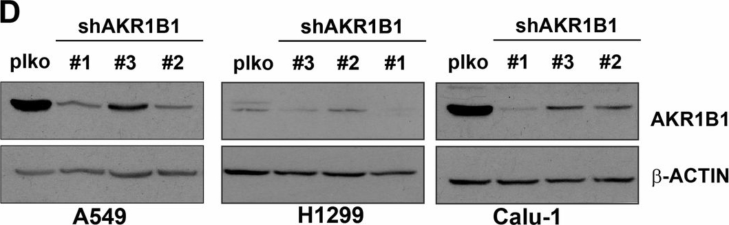 Fig.1.D showing Western Blotting in a Homo sapiens (Human) sample from the publication: Polyol pathway-generated fructose is indispensable for growth and survival of non-small cell lung cancer.