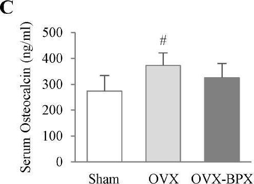 Fig.4.C showing Enzyme-linked immunosorbent assay from the publication: A Mixture of Cervus elaphus sibiricus and Glycine max (L.) Merrill Inhibits Ovariectomy-Induced Bone Loss Via Regulation of Osteogenic Molecules in a Mouse Model.