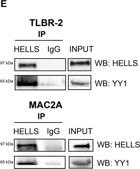 Fig.3.E showing Immunoprecipitation in a Homo sapiens (Human) sample from the publication: The DNA-helicase HELLS drives ALK- ALCL proliferation by the transcriptional control of a cytokinesis-related program.
