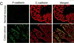 Fig.1.C showing Immunohistochemistry-immunofluorescence from the publication: P-Cadherin Regulates Intestinal Epithelial Cell Migration and Mucosal Repair, but Is Dispensable for Colitis Associated Colon Cancer.