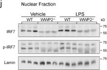Fig.6.I showing Western Blotting from the publication: The E3 ubiquitin ligase WWP2 regulates pro-fibrogenic monocyte infiltration and activity in heart fibrosis.
